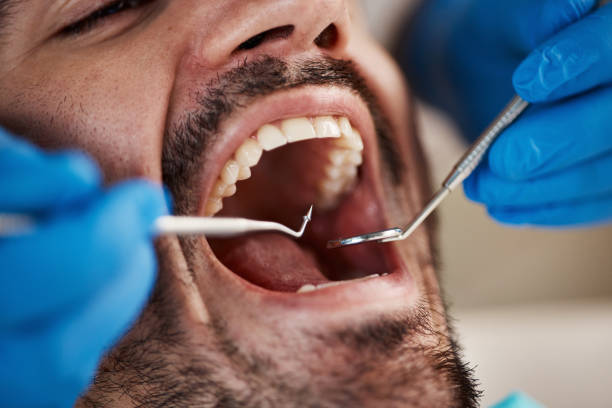 Best Emergency Tooth Extraction in Topeka, KS