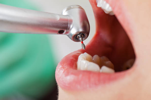 Best Emergency Treatment for Toothache in Topeka, KS